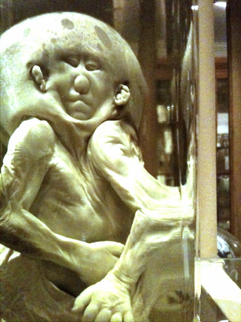 Interesting Museums in Pennsylvania Mutter Museum